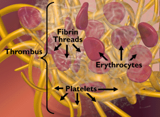 Anatomy of a Clot